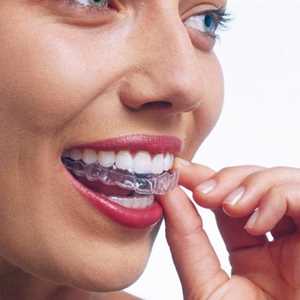 Image of Invisalign