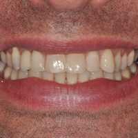 Patient after